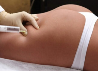 Липолитики P.I. для лица