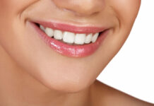 Отбеливание зубов: особенности процедуры