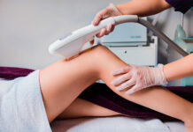 Как работает лазер для удаления волос?