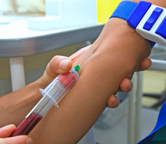 Важность раннего обнаружения ЗППП