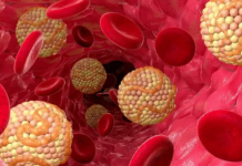 От чего зависит уровень холестерина в крови