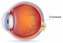 Виды заболеваний сетчатки