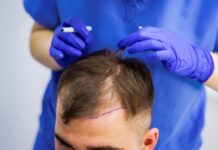 Почему чешется голова и как избавиться от проблемы