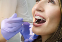 Почему клиникам и врачам ортодонтам выгодно сотрудничать со стоматологическими брендами