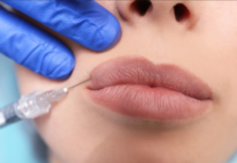 Особенности увеличения губ