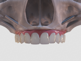 Особенности имплантации зубов