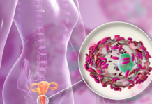 Бактериальный вагиноз