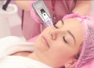 Что такое микроигольчатый RF-лифтинг Morpheus