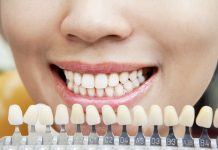 Как выбрать хорошего стоматолога? Чему следовать?