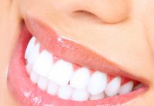 Зубные имплантаты: что они из себя представляют