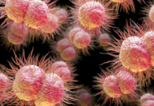 Признаки и симптомы гонореи