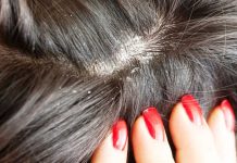 Как избавиться от перхоти на голове?