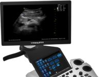 Для каких исследований нужны УЗИ-аппараты экспертного класса