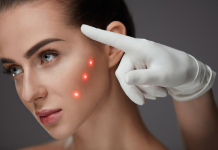 Лазерный лифтинг кожи по технологии 3D фракционирования