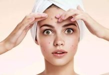 Как бороться с акне: советы