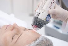 Лазерная шлифовка, как эффективный метод омоложения и борьбы с несовершенствами