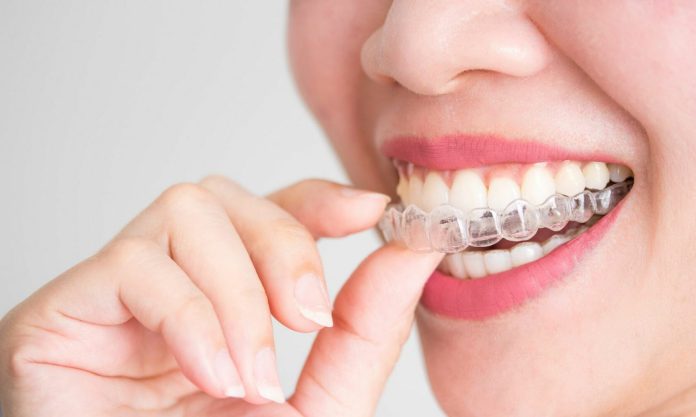 aligners