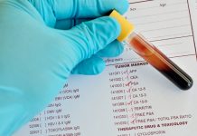 Где недорого сдать анализы на раковые клетки?