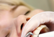 Зачем и как проводится ультразвуковая зубная чистка: подробности