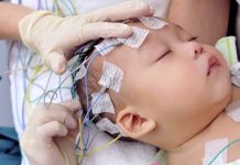 Разновидности детской эпилепсии: ее комплексное лечение