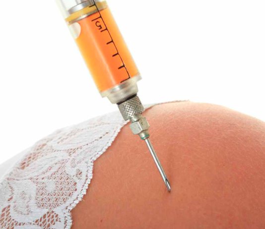 Липофилинг: эффективный способ улучшить свой внешний вид