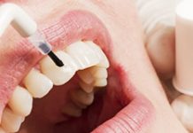 Чем отличается профессиональная стоматологическая гигиена от доступной в домашних условиях: подробности