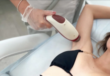 Лазерная эпиляция подмышек: почему это выгодно?