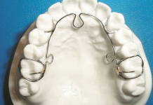 Применение аппарата Alf для лечения неправильного прикуса и других проблем со здоровьем: подробности