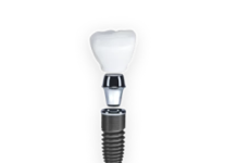 Импланты и коронки: сравнение и различия