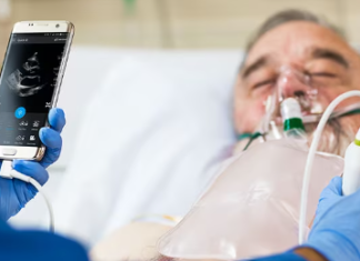 Мобильное устройство для проведения УЗ диагностики: почему компактное устройство облегчает работу медперсонала