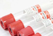 Какой эффект можно получить с помощью плазмолифтинга: какими плюсами обладает процедура