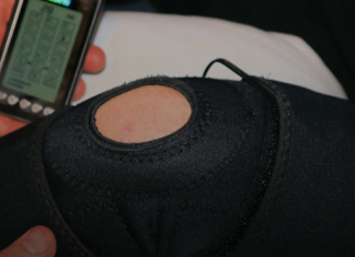 Для чего нужна физиотерапия: подробности