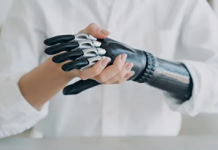 Какие протезы верхних конечностей пользуются популярностью на современном рынке: подробности