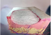 4 ошибки применения китайских мазей: с примерами