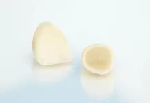 Какие коронки сделают улыбку красивой, естественной и долго прослужат: подробности