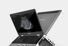 Выбор ультразвукового сканера: критерии