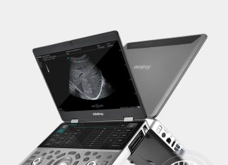 Выбор ультразвукового сканера: критерии