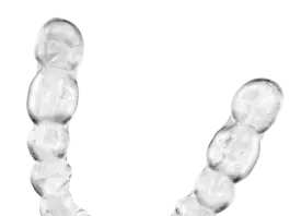 Элайнеры для подростков: плюсы