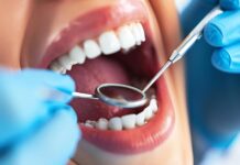 Ретейнеры для выравнивания зубов: что нужно знать?