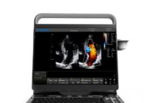 УЗИ-аппараты «Глобал Медикал Трейд»: высокотехнологичная диагностика для современной медицины