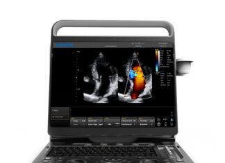 УЗИ-аппараты «Глобал Медикал Трейд»: высокотехнологичная диагностика для современной медицины