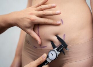 Липоскульптурирование: создание идеальной фигуры