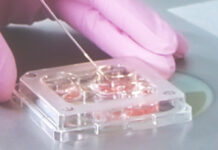 Экстракорпоральное оплодотворение: рекомендации и этапы процедуры