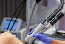 Лазерная эпиляция после родов: когда лучше начать