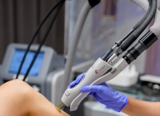 Лазерная эпиляция после родов: когда лучше начать