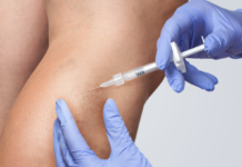 Склеротерапия вен: что это такое и как проходит процедура