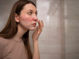 Как выбрать идеальную косметику для проблемной кожи: советы дерматологов