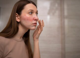 Как выбрать идеальную косметику для проблемной кожи: советы дерматологов