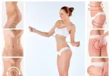 Абдоминальная липосакция в Краснодаре: всё, что нужно знать перед процедурой