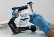 Имплантация и остеопластика: что нужно знать